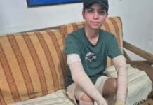 Córdoba: le estalló el celular, se le quemó el 68% del cuerpo y le dieron el alta tras dos meses internado